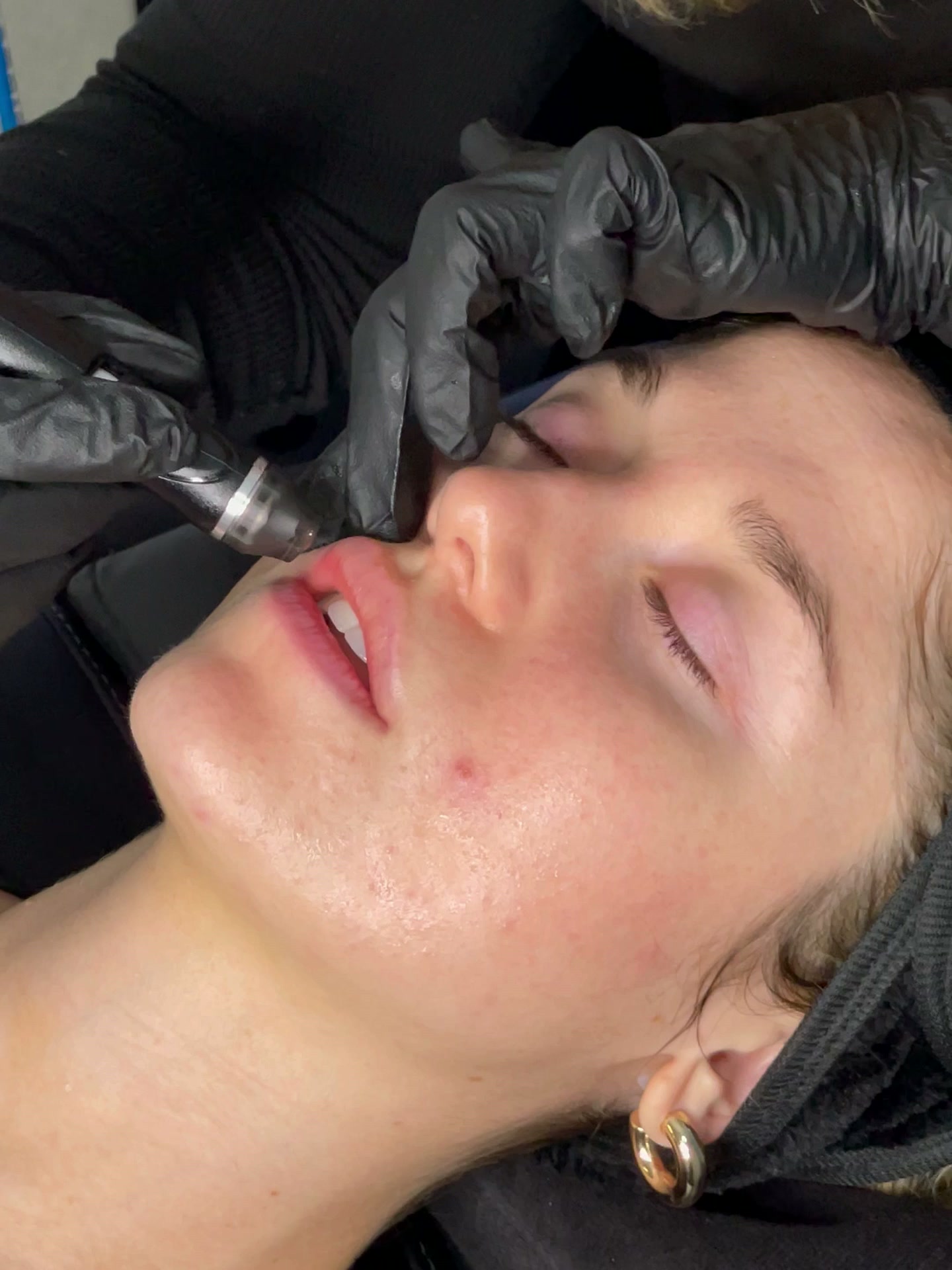 Soin Hydrafacial Deluxe réalisé au Conservatoire de la Beauté Paris