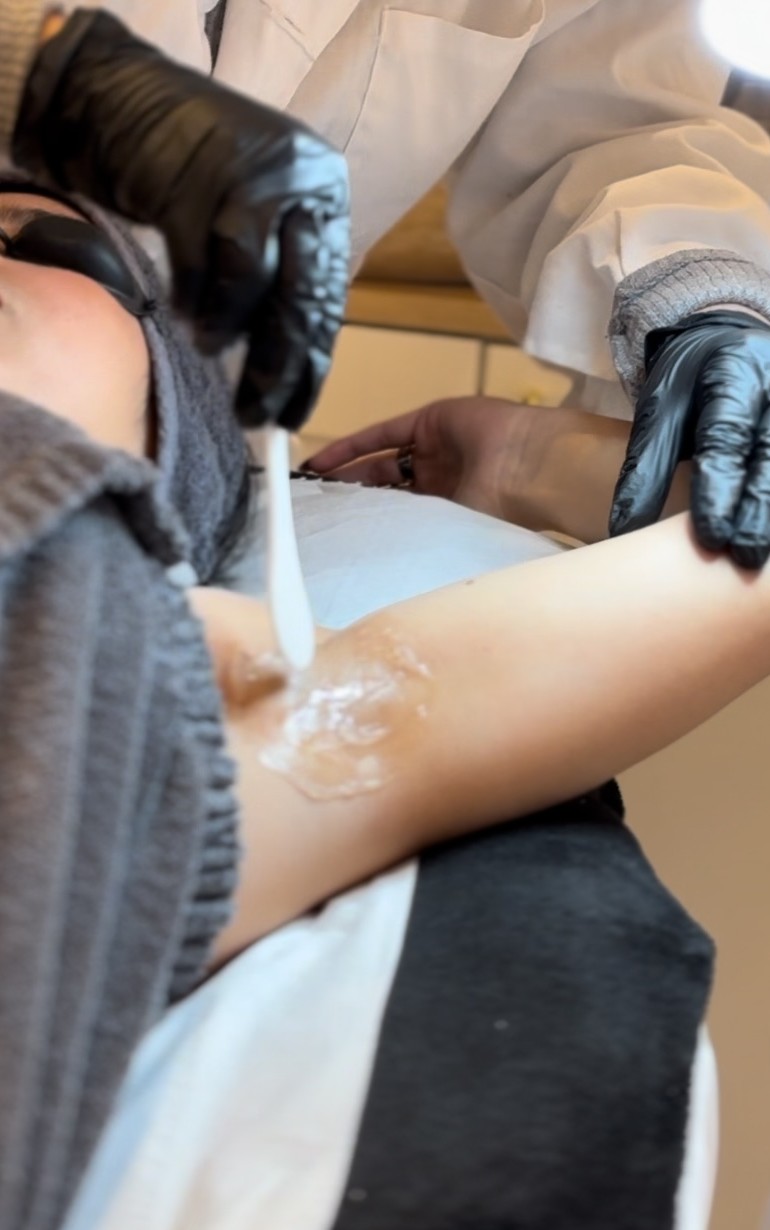 Séance d'épilation laser réalisée par une praticienne