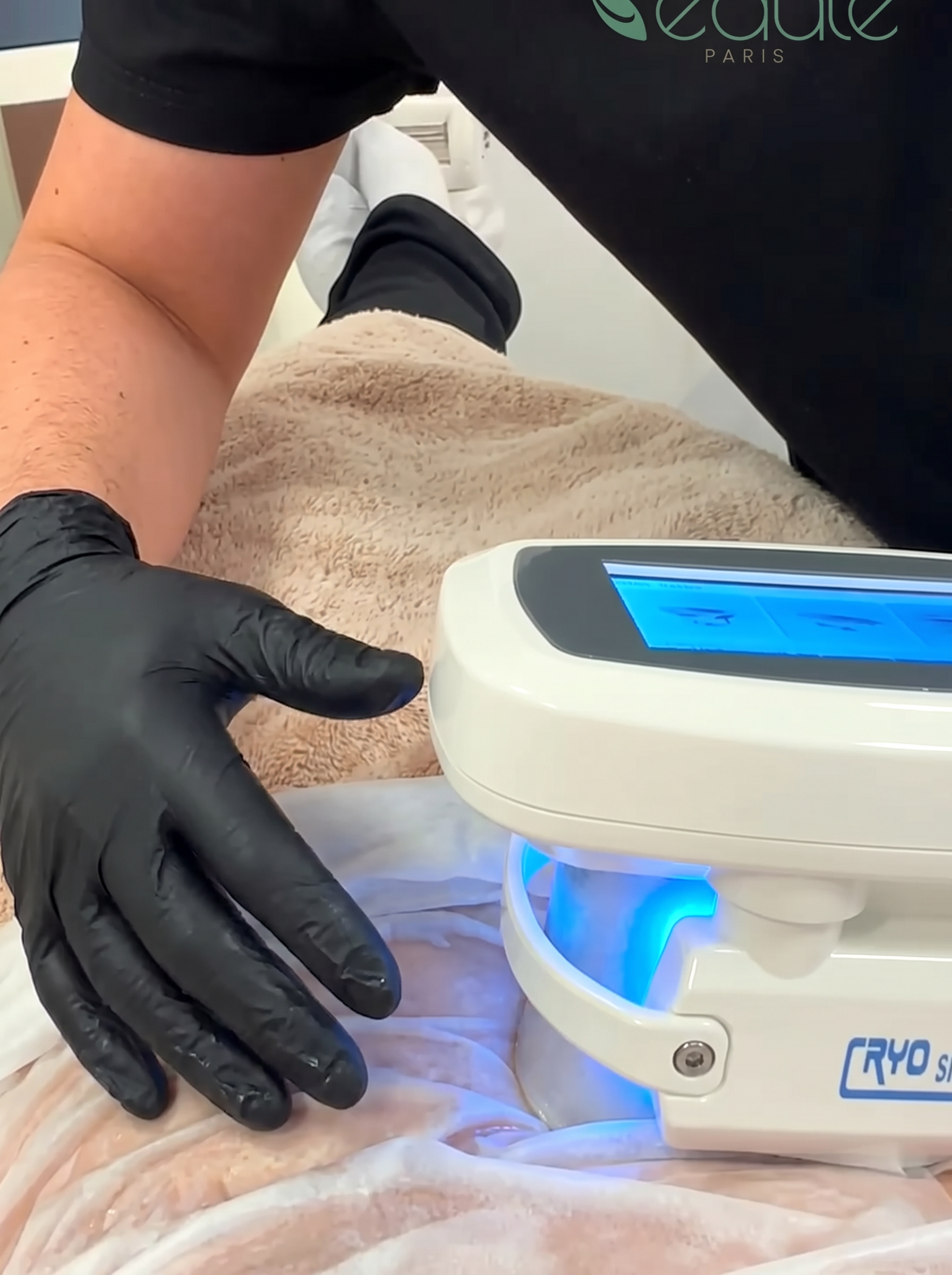 Séance réelle de cryolipolyse au Conservatoire de la Beauté Paris